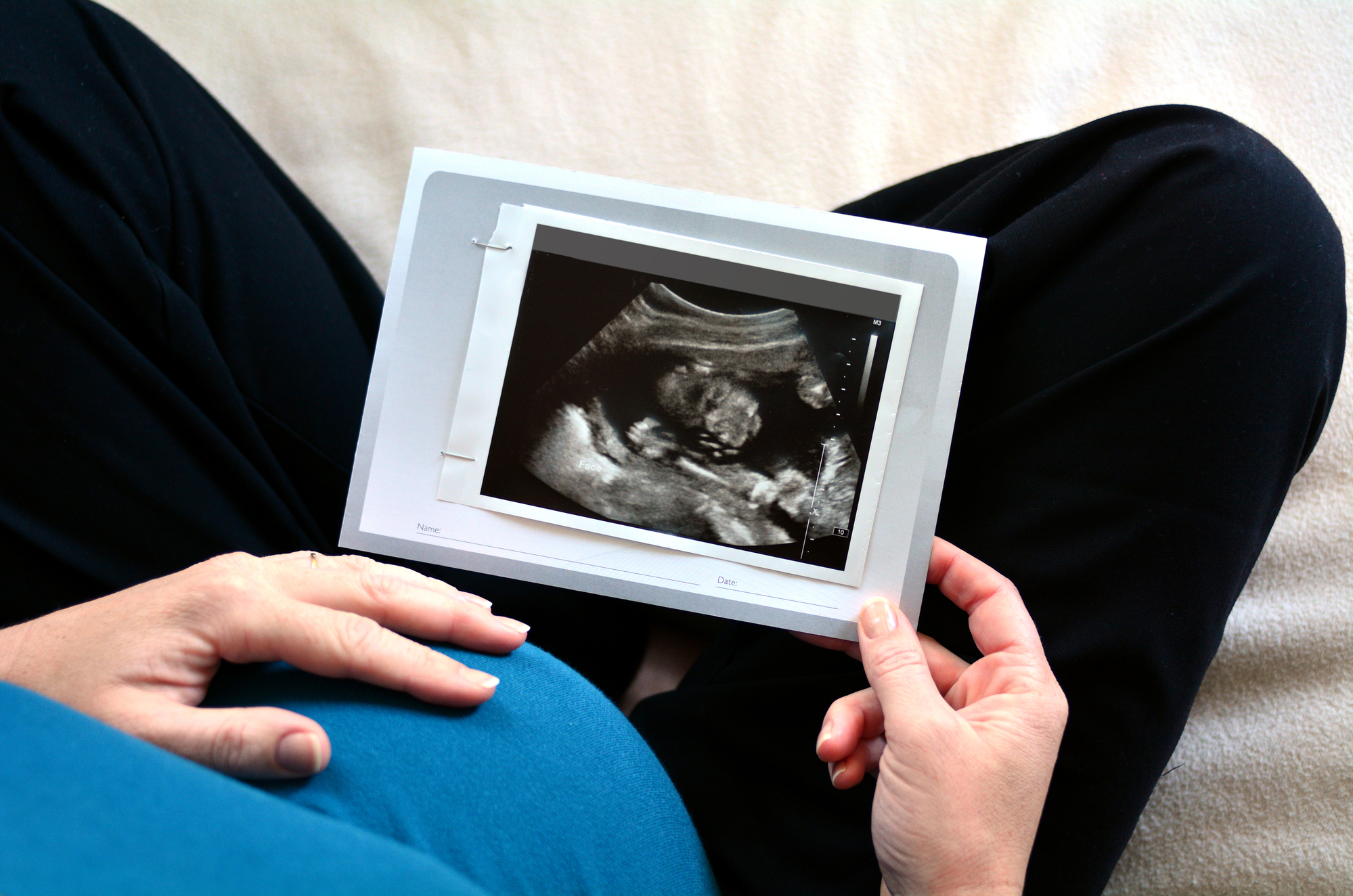 Pregnant woman looking at ultrasound scan of baby